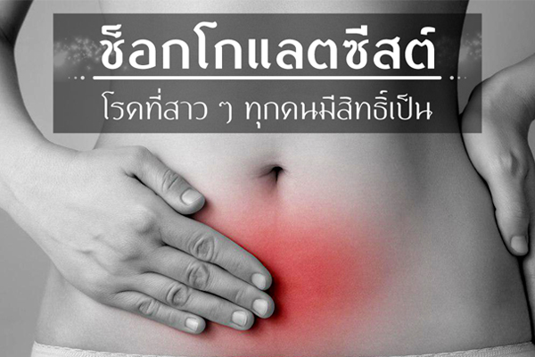 ช็อกโกแลตซีสต์ ช็อกโกแลตซีสต์