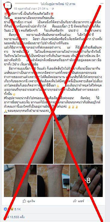 กินชาเย็น-กาแฟ เป็นโรคมือชาจริงหรือ กินชาเย็น-กาแฟ เป็นโรคมือชาจริงหรือ