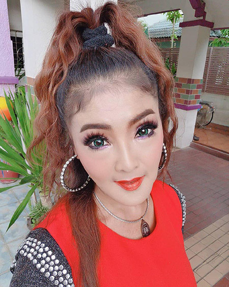 ดาว มยุรี ศัลยกรรม ดาว มยุรี ศัลยกรรม