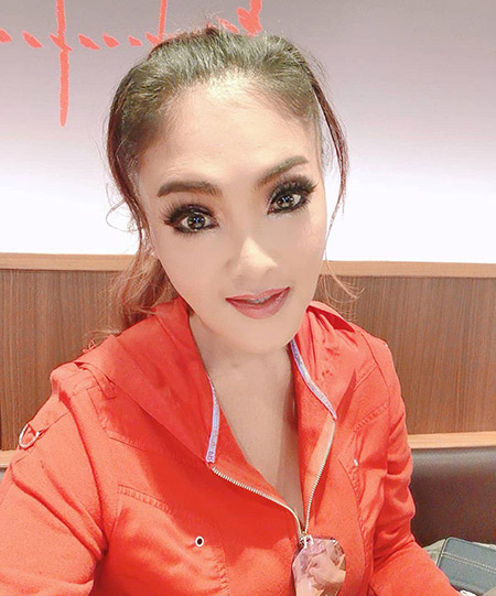 ดาว มยุรี ศัลยกรรม ดาว มยุรี ศัลยกรรม
