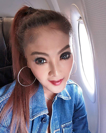 ดาว มยุรี ศัลยกรรม ดาว มยุรี ศัลยกรรม
