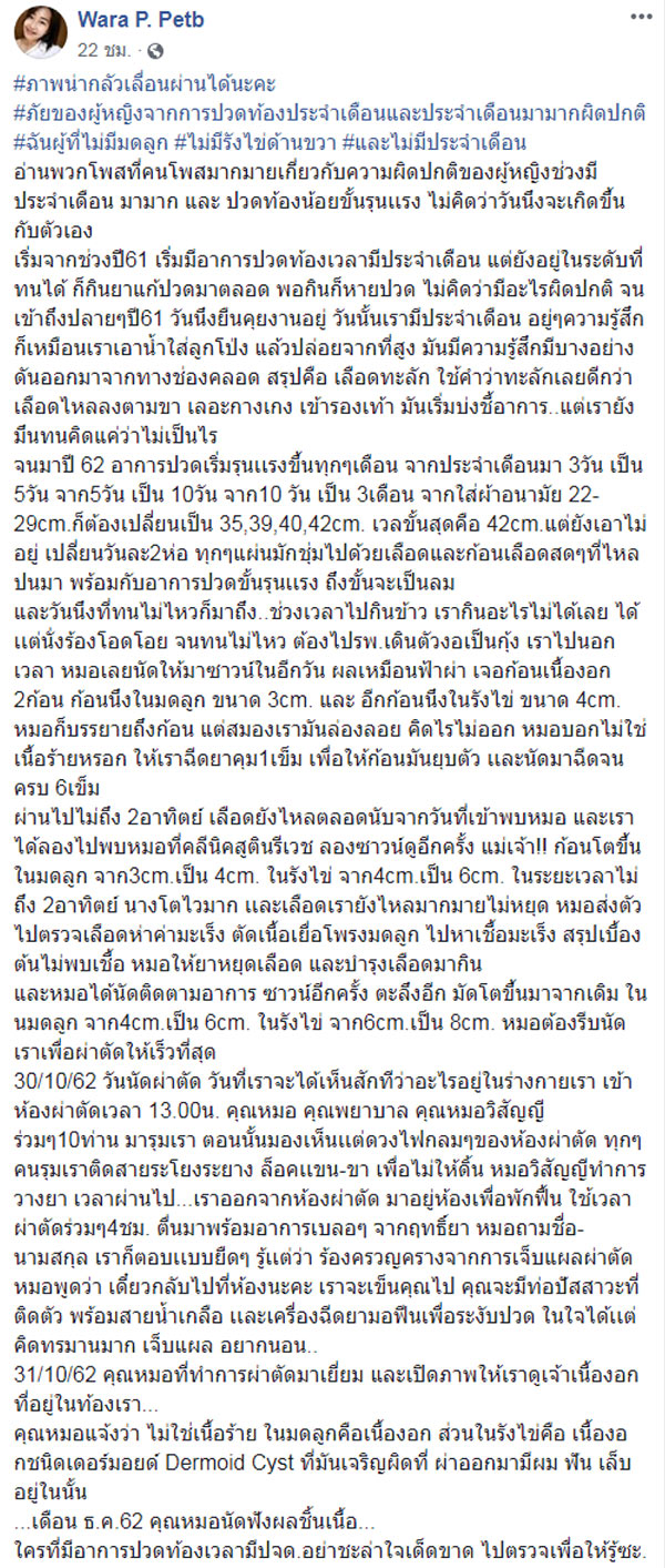 เดอร์มอยด์ ซีสต์ เดอร์มอยด์ ซีสต์