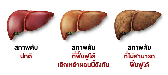 ฟื้นฟูตับ ฟื้นฟูตับ