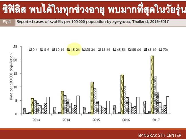 โรคซิฟิลิส โรคซิฟิลิส