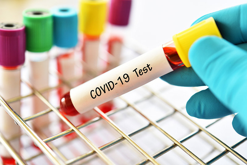 รายแรกในกาฬสินธุ์ ติด COVID-19 รายแรกในกาฬสินธุ์ ติด COVID-19