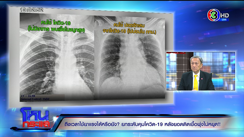 โควิด 19 โควิด 19