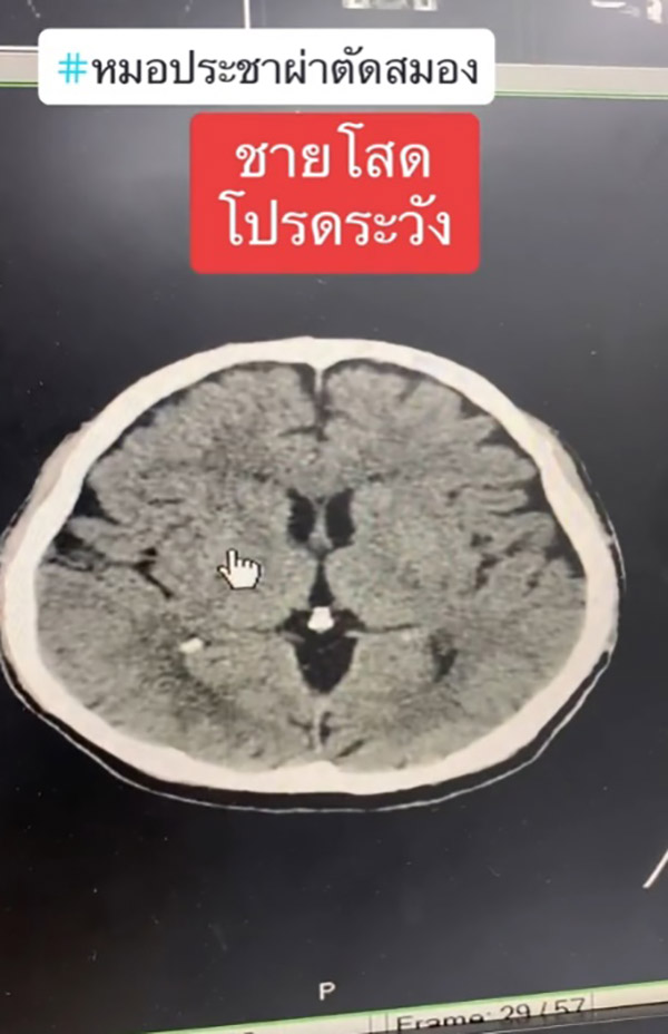 หมอเตือน หมอเตือน