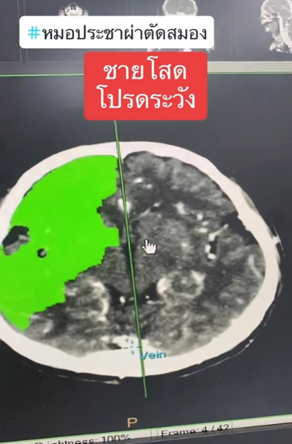 หมอเตือน หมอเตือน
