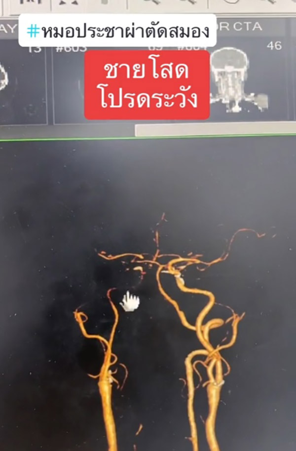 หมอเตือน หมอเตือน