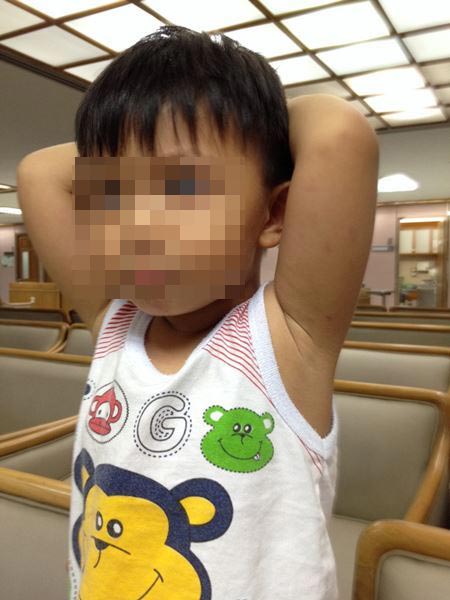 ผู้ปกครองโพสต์แฉ ครูเนิร์สเซอรี่เถื่อน ทำร้ายลูก 2 ขวบ ผู้ปกครองโพสต์แฉ ครูเนิร์สเซอรี่เถื่อน ทำร้ายลูก 2 ขวบ