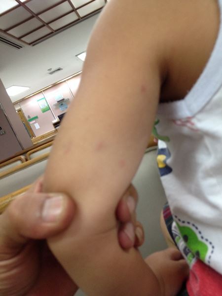 ผู้ปกครองโพสต์แฉ ครูเนิร์สเซอรี่เถื่อน ทำร้ายลูก 2 ขวบ ผู้ปกครองโพสต์แฉ ครูเนิร์สเซอรี่เถื่อน ทำร้ายลูก 2 ขวบ