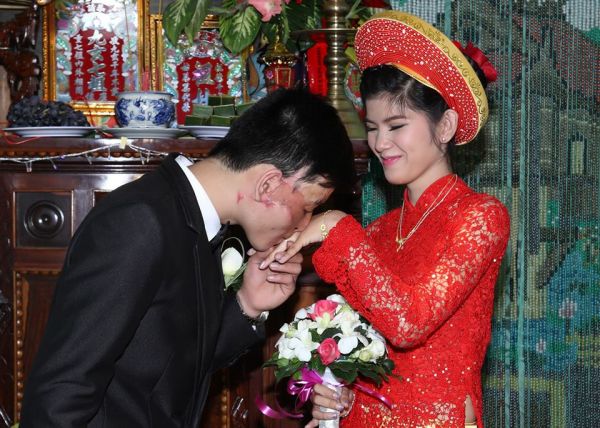 สาวเวียดนามแต่งงานกับหนุ่มเสียโฉม