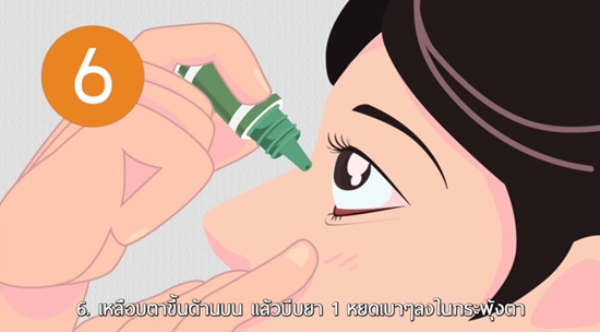 วิธีหยอดตาที่ถูกต้อง วิธีหยอดตาที่ถูกต้อง
