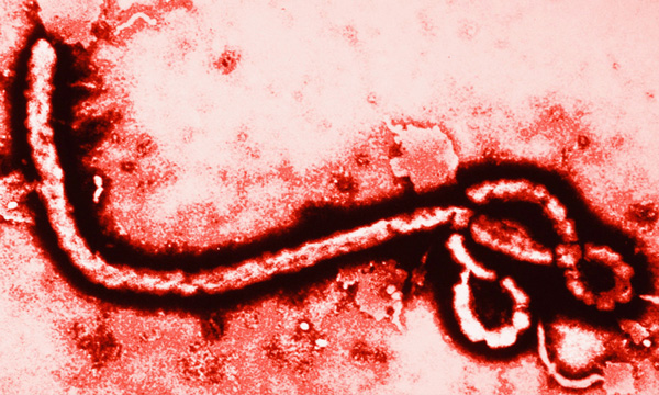ชื้อไวรัสอีโบลา
