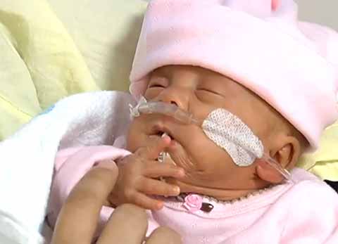 เผยโฉมทารกตัวเล็กที่สุด อันดับ 3 ของโลก หนัก 270 กรัม