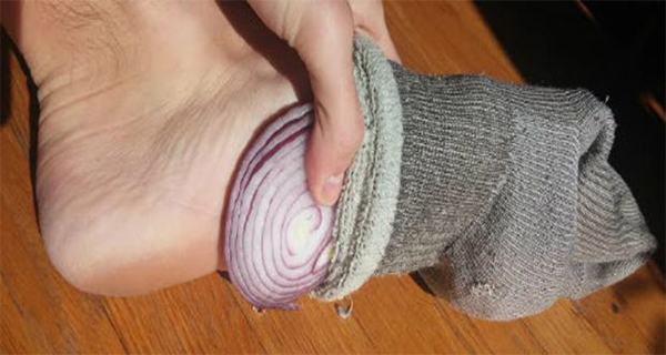ใส่หัวหอมไว้ในถุงเท้าก่อนนอน ช่วยแก้หวัด