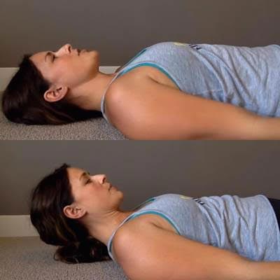 Forward head posture Forward head posture