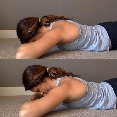 Forward head posture Forward head posture