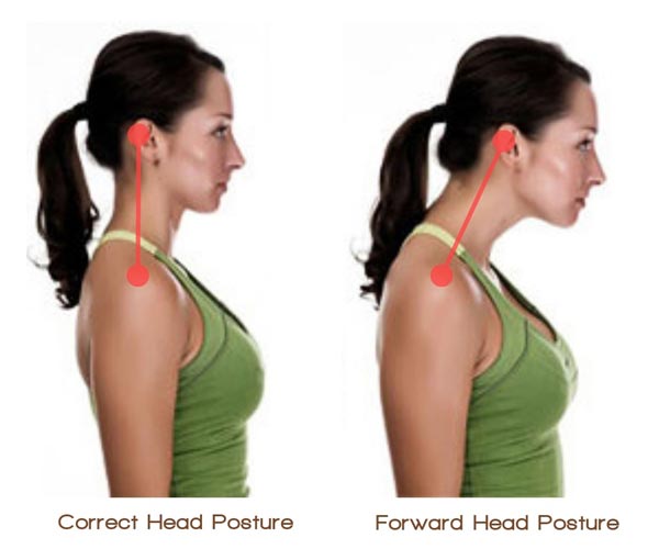 forward head posture forward head posture