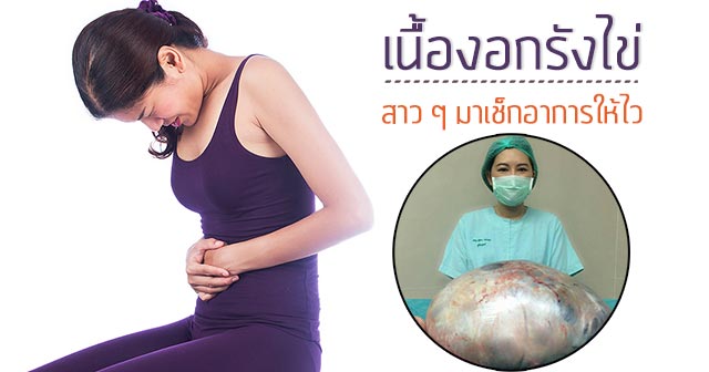 เนื้องอกรังไข่ เนื้องอกรังไข่