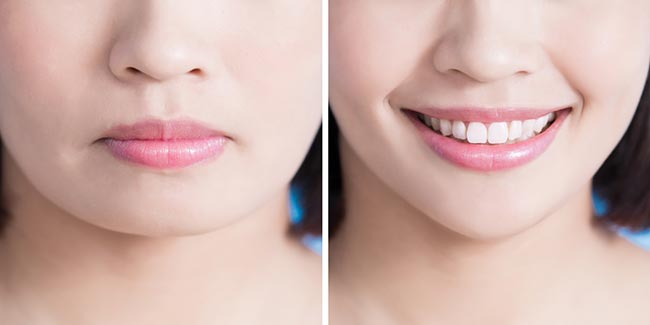 ศัลยกรรมหน้า ศัลยกรรมหน้า