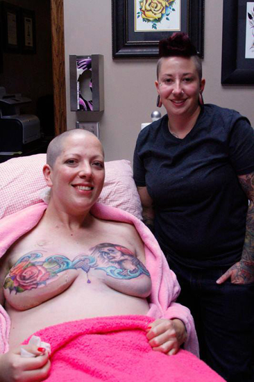 สักลาย ผู้หญิงผ่าตัดมะเร็งเต้านม