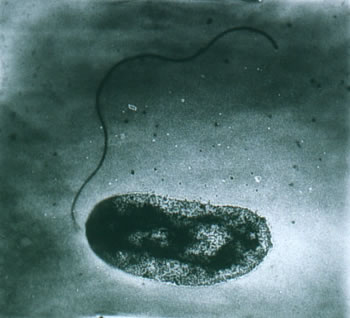 เชื้อไวบริโอ วัลนิฟิคัส (Vibrio vulnificus)