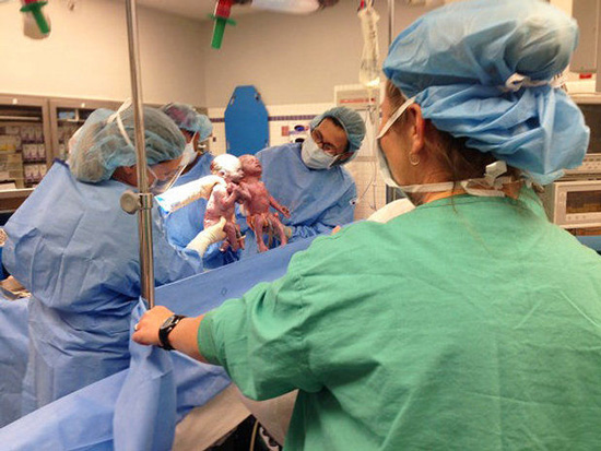 ภาพประทับใจ ทารกแฝดจับมือกันลืมตาดูโลกที่สหรัฐฯ 