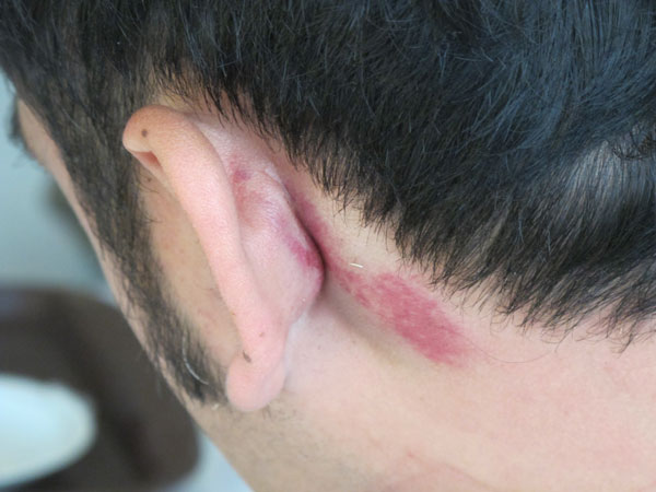 ชาลี กรรณสูต ประสบอุบัติเหตุ มอเตอร์ไซค์พลิกคว่ำ