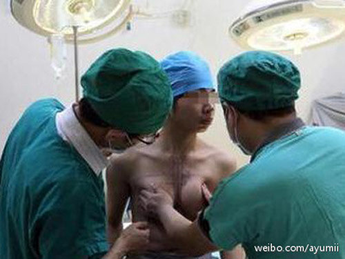 ชายจีนช็อก อยู่มา 44 ปี เพิ่งรู้ตัวเองเป็นผู้หญิง-มีมดลูก