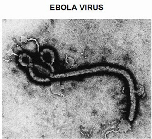 เตือนจีนเสี่ยงอีโบลาระบาด-มาตรฐานการควบคุมโรคต่ำ 