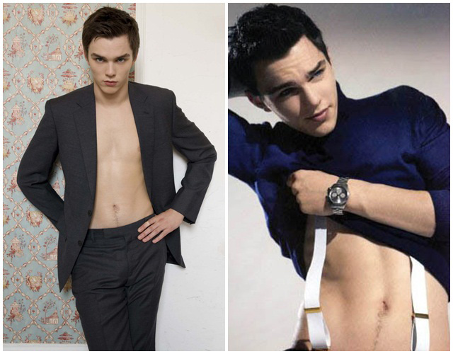 Nicholas Hoult